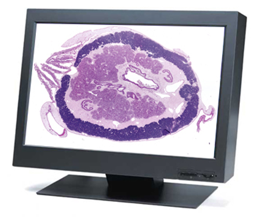 Digital Pathology Systems from AIC, Image Central autoamed reports with Pathology Database, Digitally enable the Pathology Lab, Microscopes, Digital Cameras, Image Databases, Image Central, Advanced Imaging Concepts will fully automate you microscopy suite and grossing stations, TelePthology Systems from simple using your existing technology through state of the art systems utilizing the latest in robotic microscope control systems.