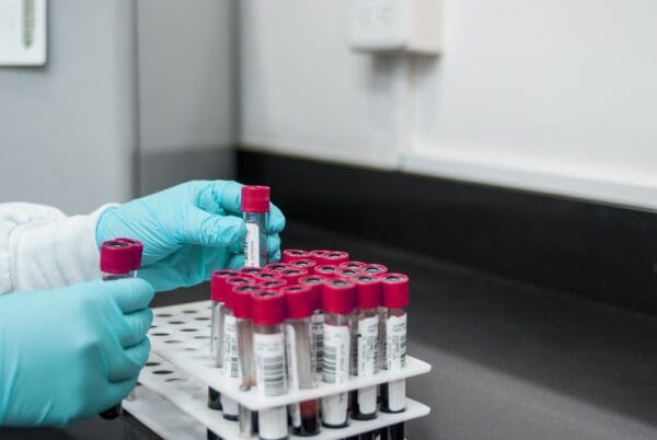 A person holding a test tube in front of a rack.