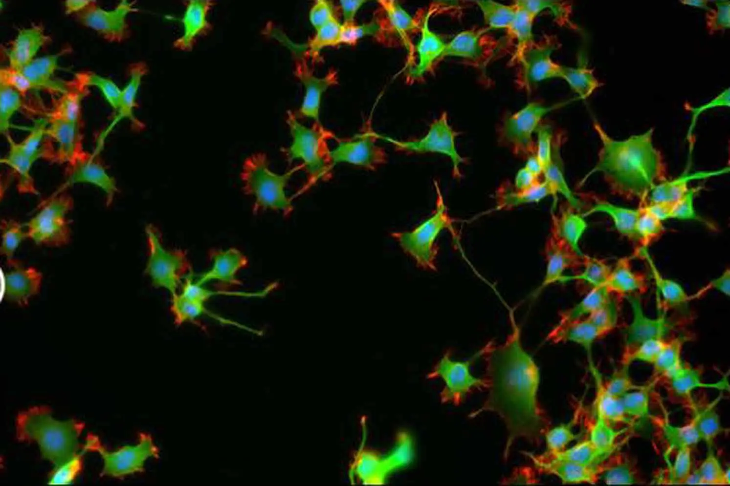 A group of neurons that are in the dark.